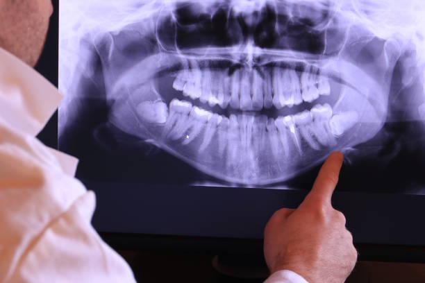 Best Emergency Dentist for Lost Fillings or Crowns in Sparks, TX